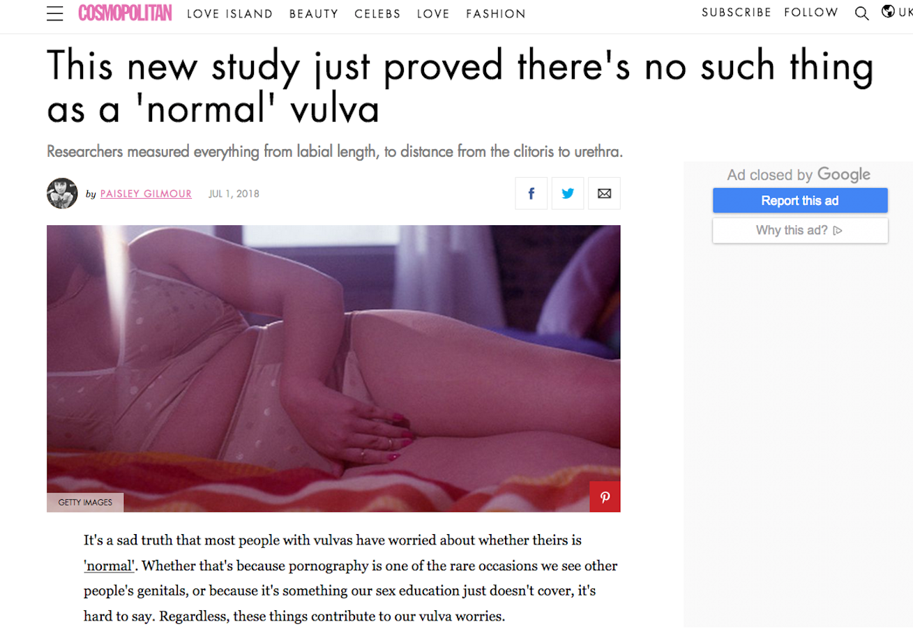 «Diese neue Studie bewies, dass es so etwas wie eine ‹normale› Vulva nicht gibt», titelte die britische Cosmopolitan.